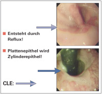 Abbildung 1: CLE
