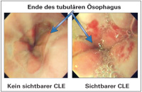 Abbildung 2: CLE
