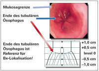 Abbildung 8: Endoskopie