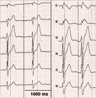 Abbildung 1: ECG leads
