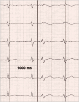 Abbildung 3: ECG leads