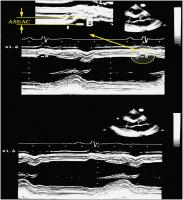 Figure 1: Athlet - ASEAC - Messung