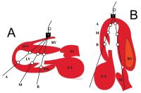 Figure 2: Athlet - Herz - Volumen