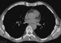 Abbildung 2: CT-Abdomen