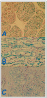 Figure 3: Nerve Roots
