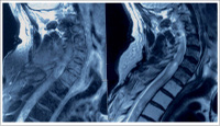 Figure 1: Thoracic Spinal Cord