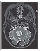 Figure 1: Axial Image