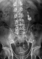 Abbildung 2: Abdomen
