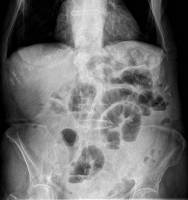 Abbildung 1: Abdomen