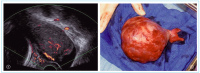 Abbildung 4a-b: Gorlin-Goltz-Syndrom