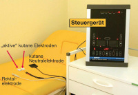 Abbildung 1: Biofeedback-Elektrotherapie-Trainingsgert