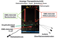 Abbildung 2: Trainingsgert Myo 420