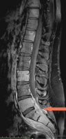 Figure 2: Spine