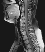 Figure 3: Spine