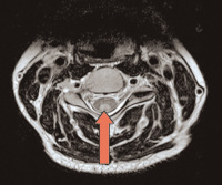Figure 1-2: Spine