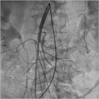 Abbildung 3: Aorta abdominalis