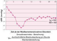Abbildung 2: Smoothness-Index