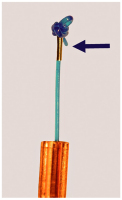 Abbildung 2: Gynefix(R)