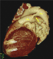 Abbildung 7: CT-PDA