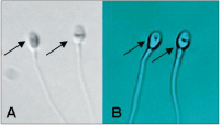 Abbildung 2a-b: Sperm