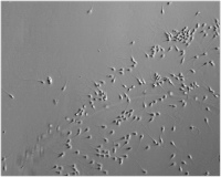 Abbildung 3: Sperm selection