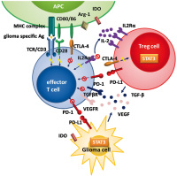 Figure 1: Glioblastoma