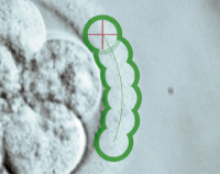 Abbildung 2: Produkt: Saturn 5 Active Laser<br>Vetrieb: GYNEMED Medizinprodukte GmbH & Co. KG