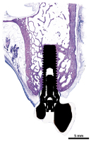 Abbildung 1: Osteoporosetherapie