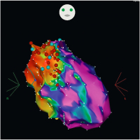 Abbildung 5: Elektroanatomisches Mapping