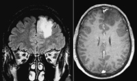 Figure 1: Brain MRI