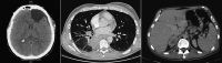 Figure 2: CT