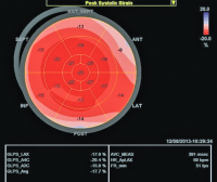 Abbildung 7: Strain-Analyse