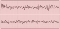 Abbildung 1: AED