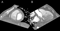 Abbildung 5: Cardiac CT