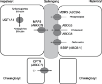 Abbildung 1: Gallensteinpathogenese
