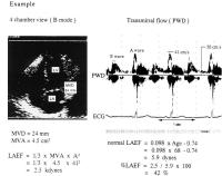 Figure 1: LAEF (Left Atrial Ejection Force)