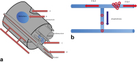 Figure 2a-b: Nerve infiltration