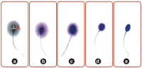 Abbildung 1: Produkt: SpermFunc DNAf-Halotest<br>Vertrieb: Gynemed GmbH