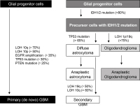 Figure 2: Glioblastoma