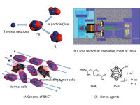 Figure 1: BNCT