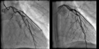 Abbildung 3a-b: Angiogramm