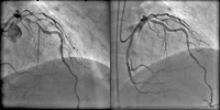 Abbildung 9a-b: Angiogramm
