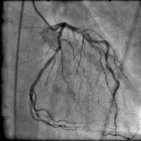 Abbildung 11: Angiogramm