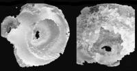 Figure 6: 3D-Echokardiographie