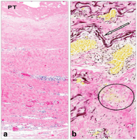 Abbildung 5a-b: Histologisches Prparat