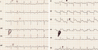 Abbildung 1: ECG