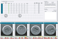Abbildung 3: Produkt: EmbryoScope<br>Vertrieb: MTG Medical