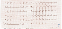 Abbildung 5: EKG