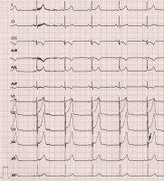 Abbildung 3: EKG