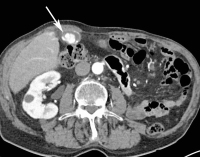Abbildung 1a: MDCT